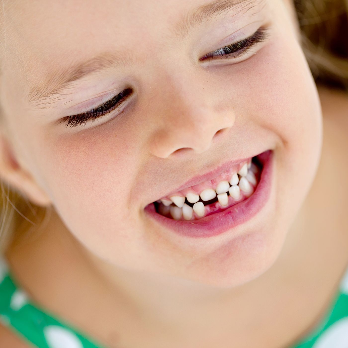Почему ребенок скрипит зубами 4 года. Кариес молочных зубов у детей. Удаление молочных зубов у детей. Запущенный кариес у детей.